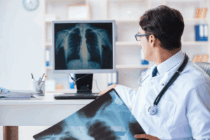Doctor looking at x-rays